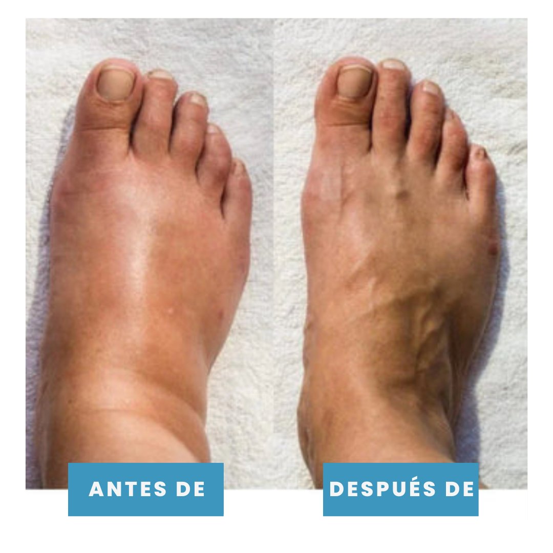 Masajeador de pies EMS Terapéutico