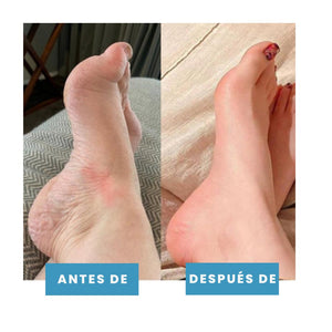 Masajeador de pies EMS Terapéutico